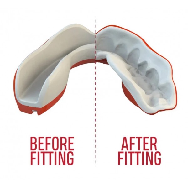 Protège-dents - Safejawz Extro Series Self-Fit
